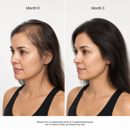 Batana Oil - For Thicker, Fuller & Healthier Hair
